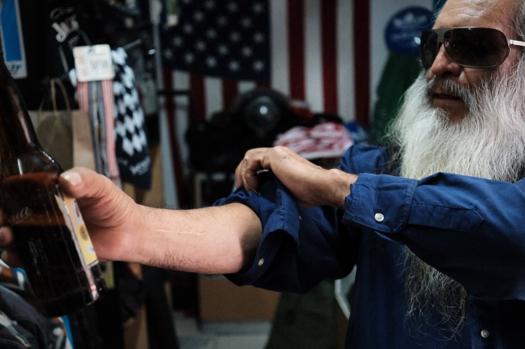 Hombre con larga barba blanca con una cicatriz en la mano sosteniendo una cerveza